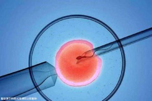 42岁高龄成功案例